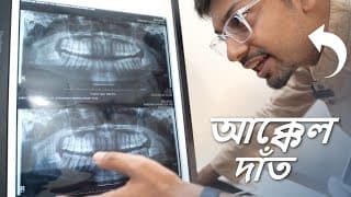 আক্কেল দাঁত উঠার এক্সপিরিয়েন্স I White Flag