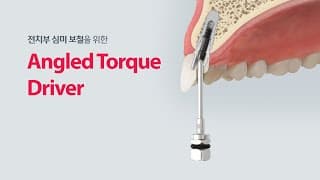 [KIT] Angled Torque Driver_전치부 심미 보철을 위한 Driver