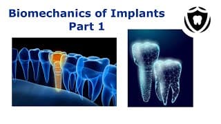 Biomechanics of dental implants Part 1