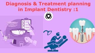 Diagnosis & Treatment Planning in Implant Dentistry: part 1