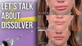 Let's Talk About Dissolver | Lesson Of The Day