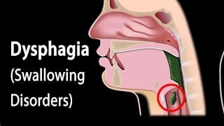 Dysphagia, Animation.