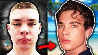 The Curious Case of Clavicular