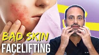 Facelifting with Problematic Skin | Lesson of the Day