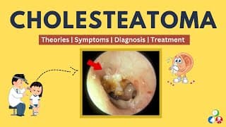 Cholesteatoma - Symptoms, Causes, Theories, Treatment