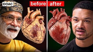 Insulin Doctor: The Fastest Way To Burn Dangerous Visceral Fat! This Is Clotting Your Blood!