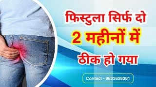 Fistula treatment I Anal Fistula recovery story