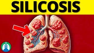 What is Silicosis? (EXPLAINED)
