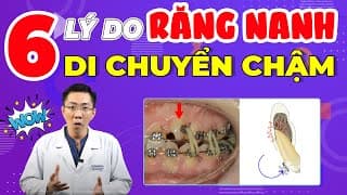 Răng Nanh Kéo Mãi Vẫn Không Dịch Chuyển | Nguyên Nhân Là Do Đâu?